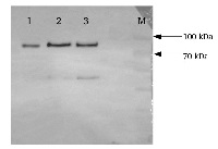 ACC synthase 7 | 1-aminocyclopropane-1-carboxylate synthase 7 in the group Antibodies for Plant/Algal  / Hormones / Biosynthesis/regulation at Agrisera AB (Antibodies for research) (AS14 2774)